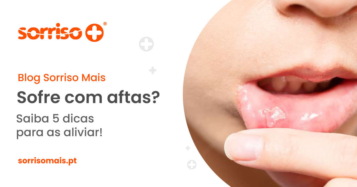 5 dicas para aliviar aftas - Sorriso Mais