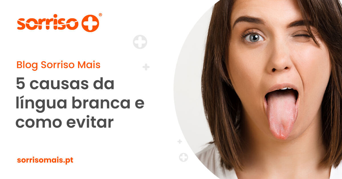 5 causas da língua branca e como a evitar - Sorriso Mais